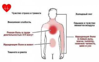 Наслідки стенокардії — симптоми і способи лікування, профілактика