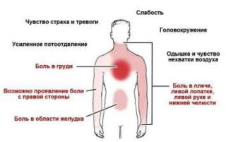 Діагностика стенокардії — навантажувальні тести, сцинтиграфія серця, коронарографія