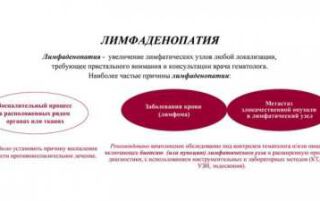 Запалення лімфовузлів черевної порожнини у дорослих — симптоми