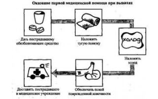 Що не можна робити при вивиху — послідовність правильних дій з описом